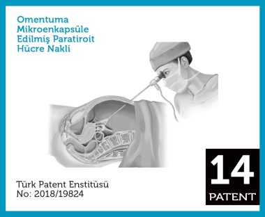 Omentuma Mikroenkapsüle Edilmiş Paratiroit Hücre Nakli