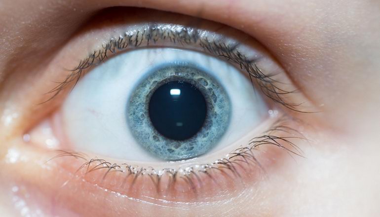 Her Tiroid Hastalığı Gözlere Vurur mu?